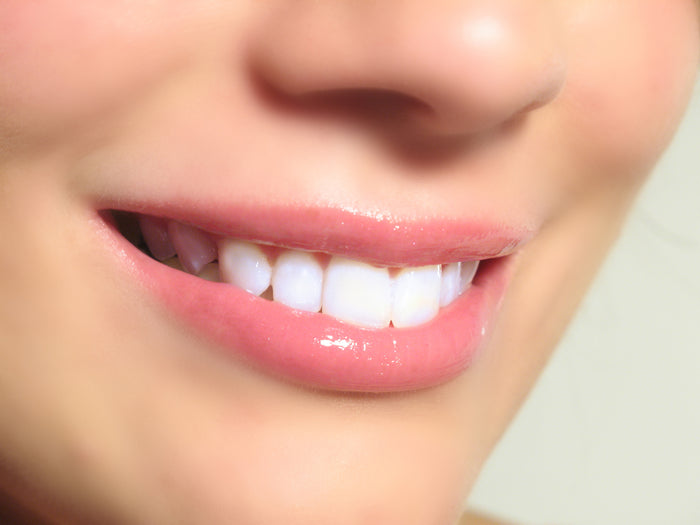 Sparkle White Teeth Whitening Kit w/Coconut Activated Charcoal